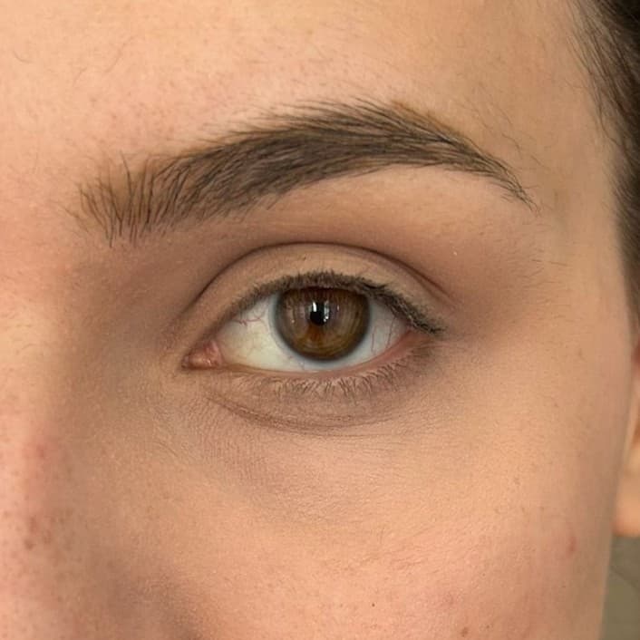 Aurora - before